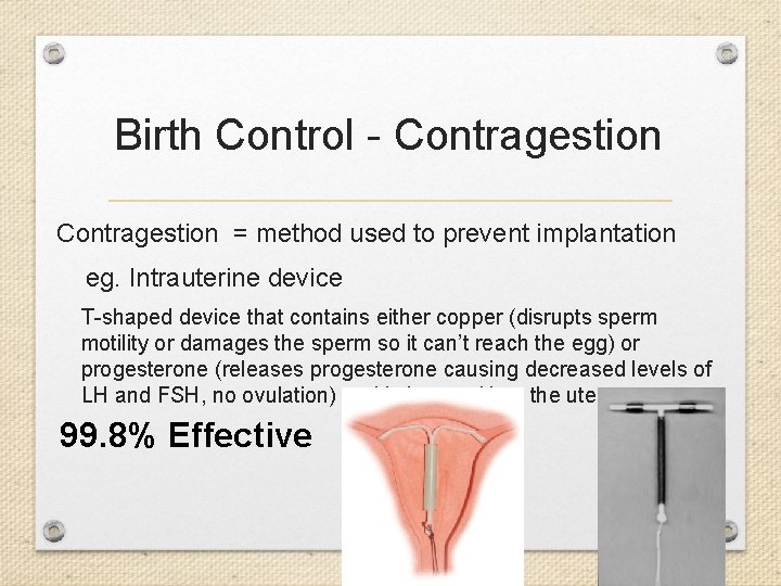 Birth Control - Contragestion = method used to prevent implantation eg. Intrauterine device T-shaped