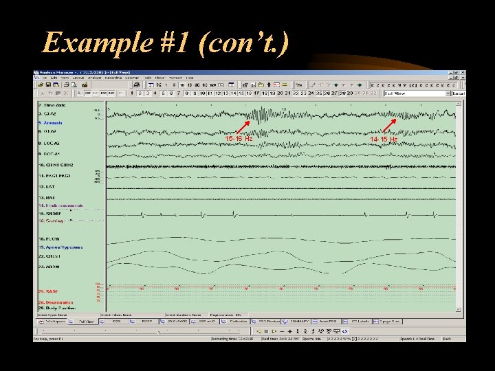 Example #1 (con’t. ) 15 -16 Hz 14 -15 Hz 