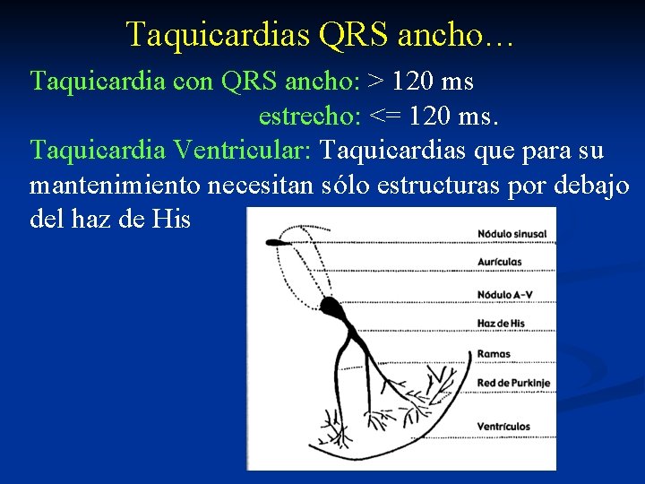 Taquicardias QRS ancho… Taquicardia con QRS ancho: > 120 ms estrecho: <= 120 ms.