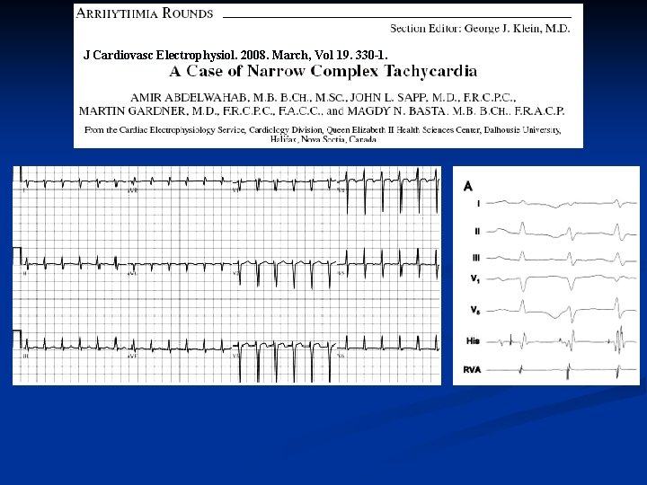 J Cardiovasc Electrophysiol. 2008. March, Vol 19. 330 -1. 