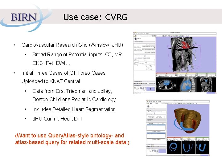 Use case: CVRG • Cardiovascular Research Grid (Winslow, JHU) • Broad Range of Potential