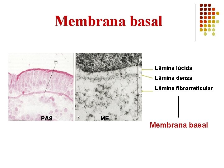 Membrana basal Lâmina lúcida Lâmina densa Lâmina fibrorreticular PAS ME Membrana basal 