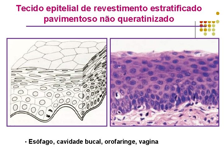 Tecido epitelial de revestimento estratificado pavimentoso não queratinizado • Esôfago, cavidade bucal, orofaringe, vagina