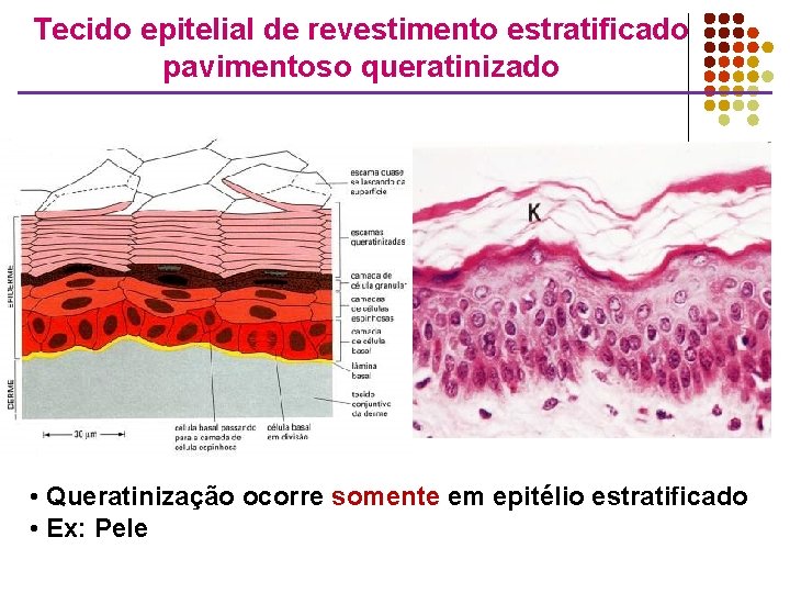 Tecido epitelial de revestimento estratificado pavimentoso queratinizado • Queratinização ocorre somente em epitélio estratificado