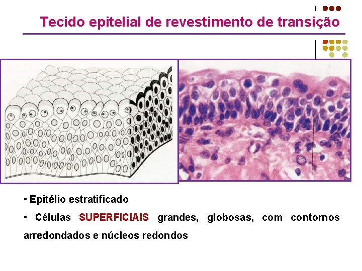 Tecido epitelial de revestimento de transição • Epitélio estratificado • Células SUPERFICIAIS grandes, globosas,