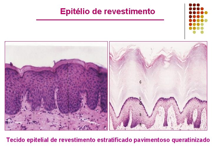 Epitélio de revestimento Tecido epitelial de revestimento estratificado pavimentoso queratinizado 