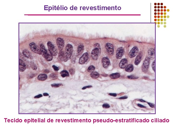 Epitélio de revestimento Tecido epitelial de revestimento pseudo-estratificado ciliado 