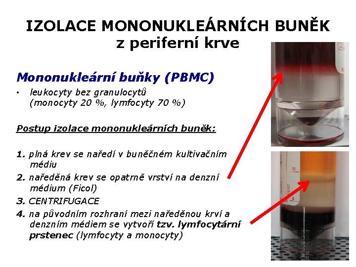 IZOLACE MONONUKLEÁRNÍCH BUNĚK z periferní krve Mononukleární buňky (PBMC) • leukocyty bez granulocytů (monocyty