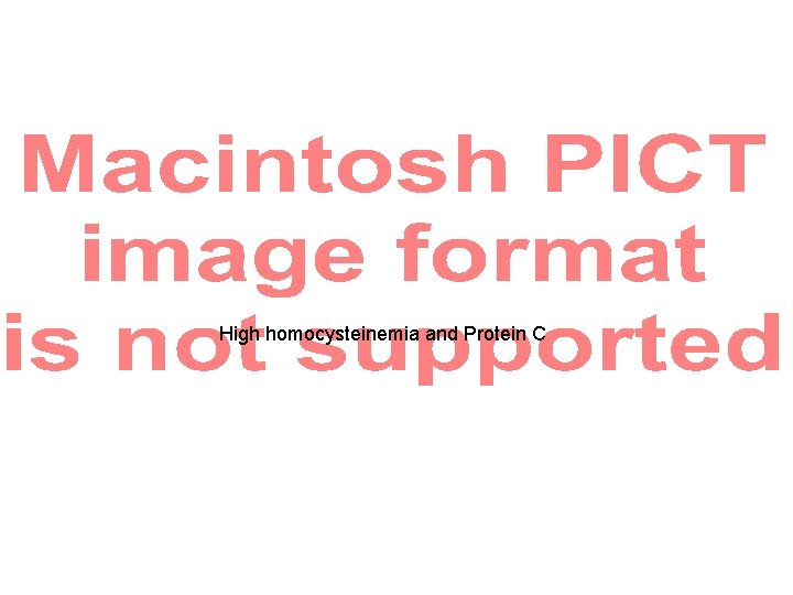 High homocysteinemia and Protein C 