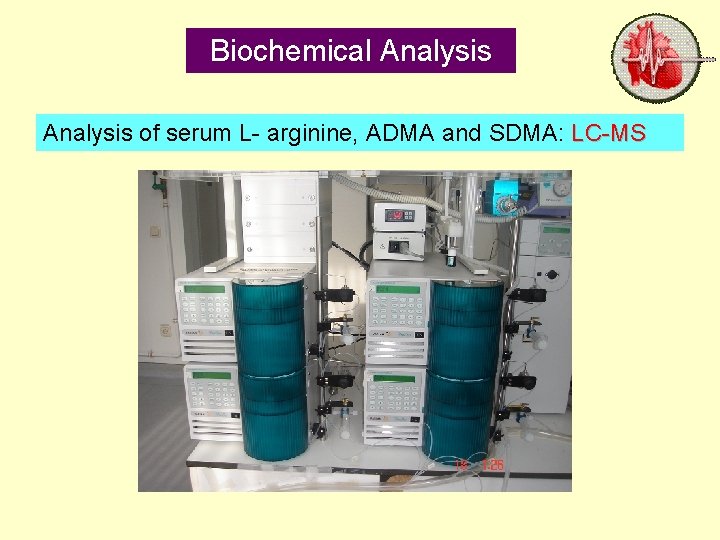 Biochemical Analysis of serum L- arginine, ADMA and SDMA: LC-MS 31 October 2021 Dr.