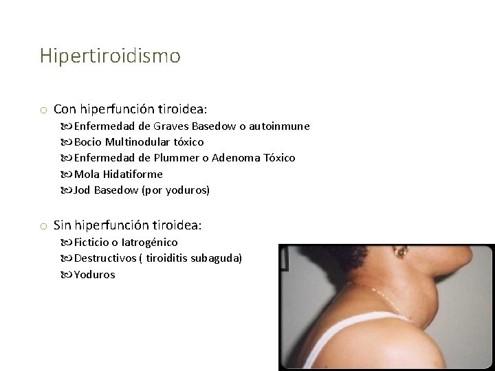 Hipertiroidismo o Con hiperfunción tiroidea: Enfermedad de Graves Basedow o autoinmune Bocio Multinodular tóxico