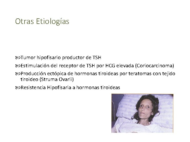 Otras Etiologías Tumor hipofisario productor de TSH Estimulación del receptor de TSH por HCG