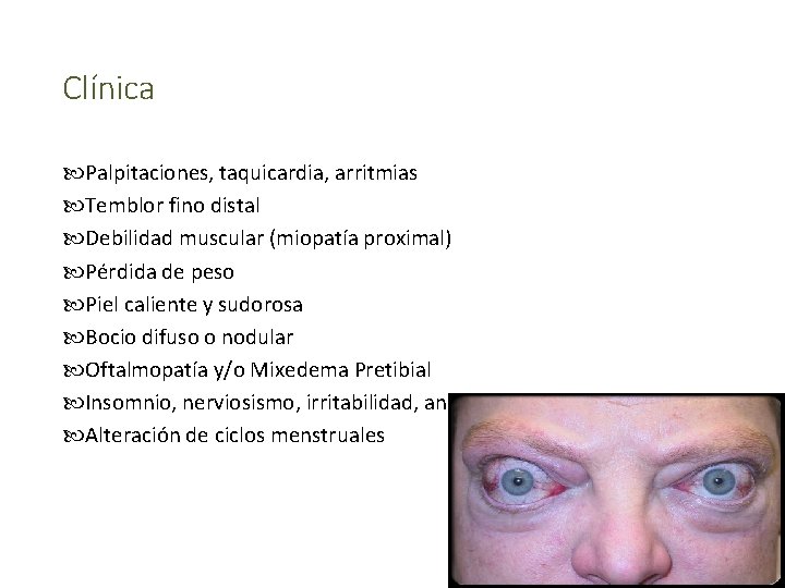 Clínica Palpitaciones, taquicardia, arritmias Temblor fino distal Debilidad muscular (miopatía proximal) Pérdida de peso