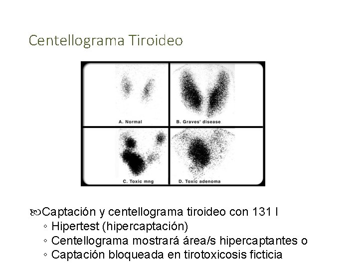 Centellograma Tiroideo Captación y centellograma tiroideo con 131 I ◦ Hipertest (hipercaptación) ◦ Centellograma