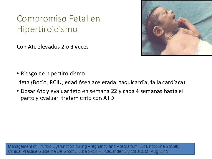 Compromiso Fetal en Hipertiroidismo Con Atc elevados 2 o 3 veces • Riesgo de
