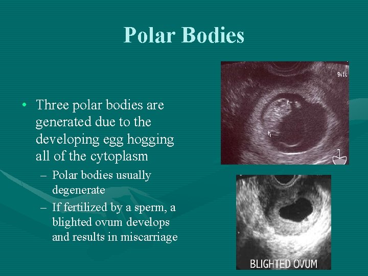 Polar Bodies • Three polar bodies are generated due to the developing egg hogging