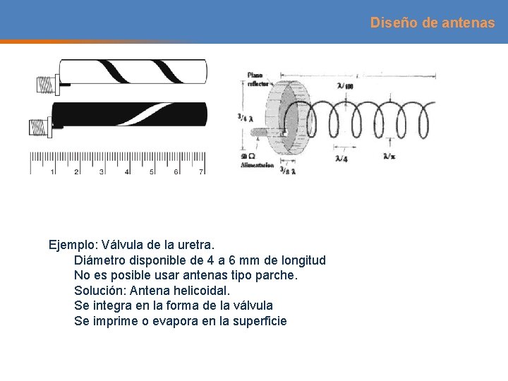 Diseño de antenas Ejemplo: Válvula de la uretra. Diámetro disponible de 4 a 6