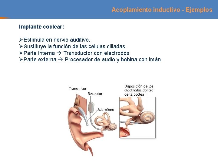 Acoplamiento inductivo - Ejemplos Implante coclear: ØEstimula en nervio auditivo. ØSustituye la función de