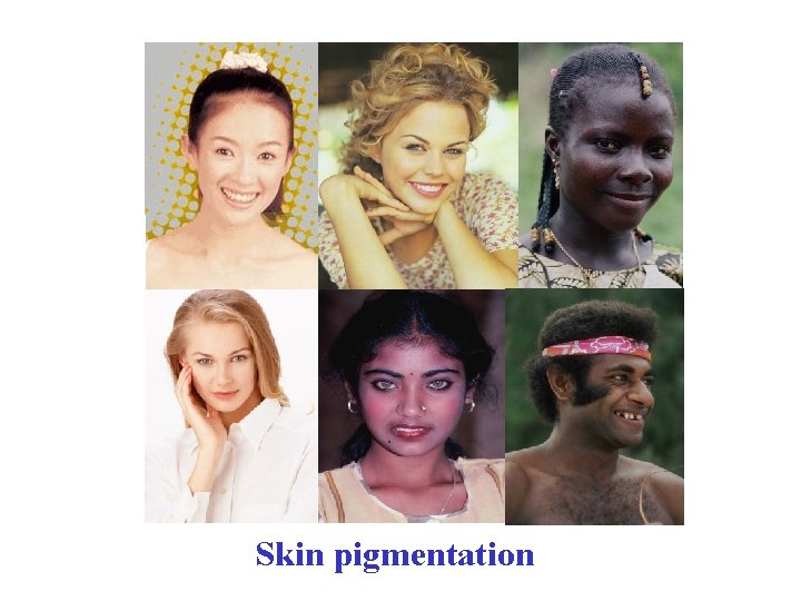 Skin pigmentation 