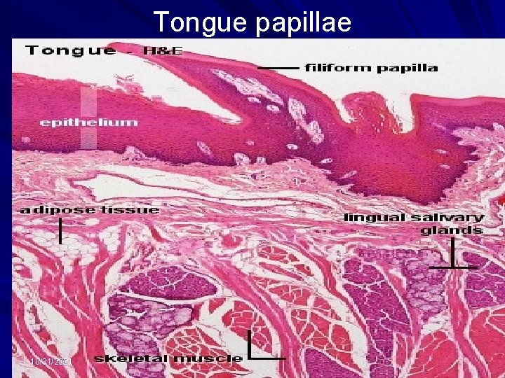 Tongue papillae 10/31/2021 