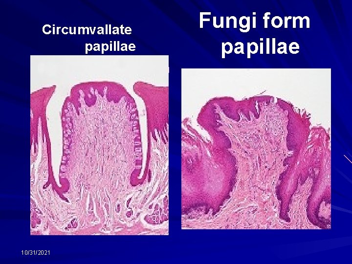 Fungi form papillae Circumvallate papillae. 10/31/2021 