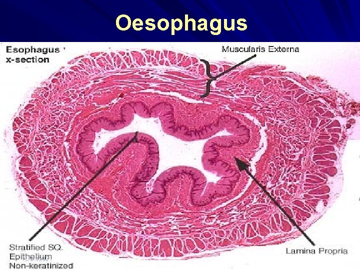 Oesophagus 10/31/2021 