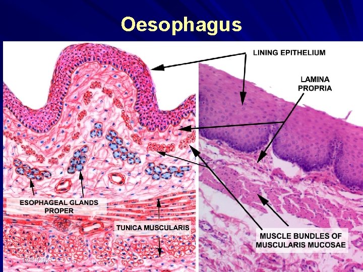 Oesophagus 10/31/2021 