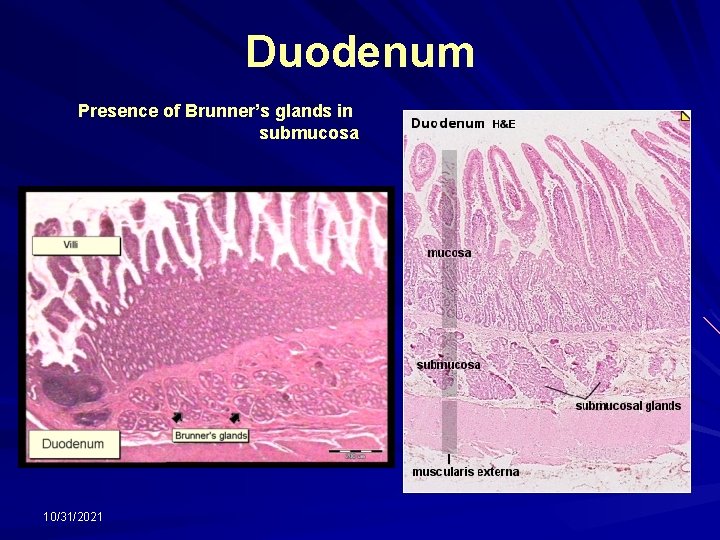 Duodenum Presence of Brunner’s glands in submucosa 10/31/2021 