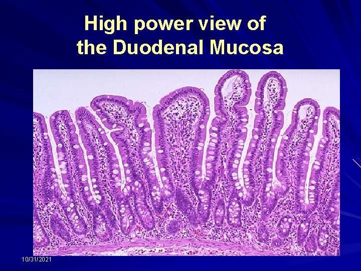 High power view of the Duodenal Mucosa 10/31/2021 