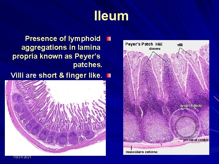 Ileum Presence of lymphoid aggregations in lamina propria known as Peyer’s patches. Villi are