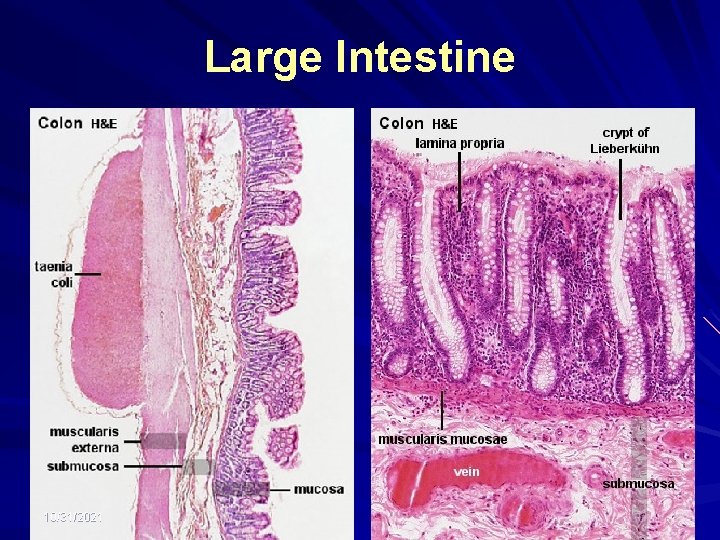 Large Intestine 10/31/2021 