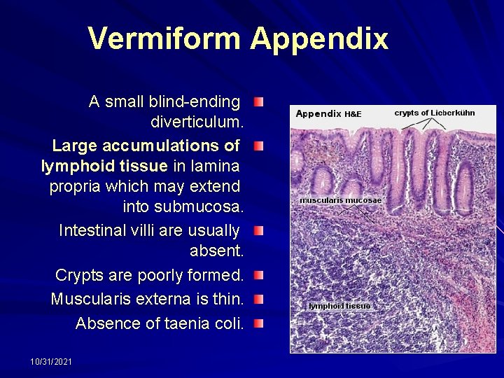 Vermiform Appendix A small blind-ending diverticulum. Large accumulations of lymphoid tissue in lamina propria