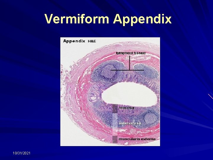 Vermiform Appendix 10/31/2021 