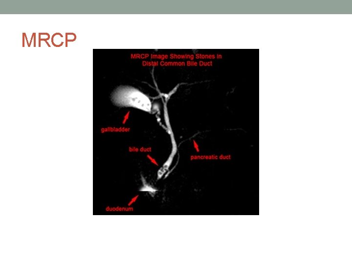 MRCP 