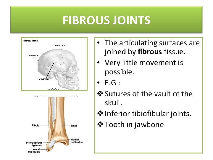 FIBROUS JOINTS • The articulating surfaces are joined by fibrous tissue. • Very little