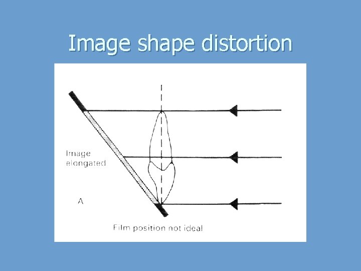 Image shape distortion 