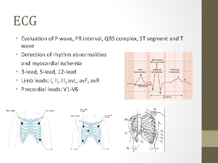 ECG • Evaluation of P wave, PR interval, QRS complex, ST segment and T