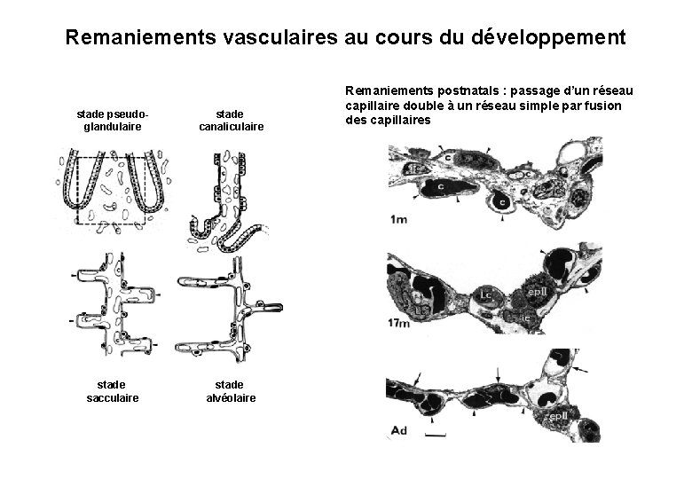 Remaniements vasculaires au cours du développement stade pseudoglandulaire stade canaliculaire stade sacculaire stade alvéolaire