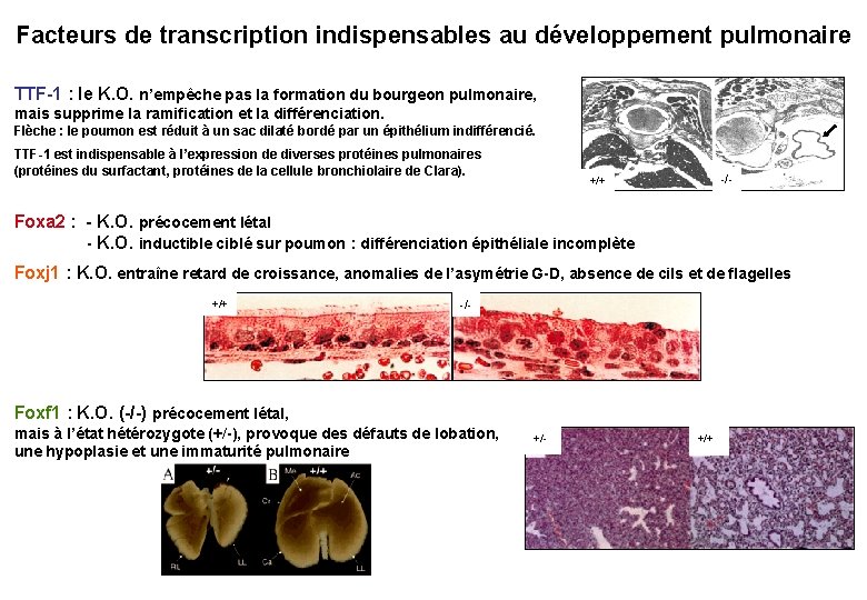 Facteurs de transcription indispensables au développement pulmonaire TTF-1 : le K. O. n’empêche pas