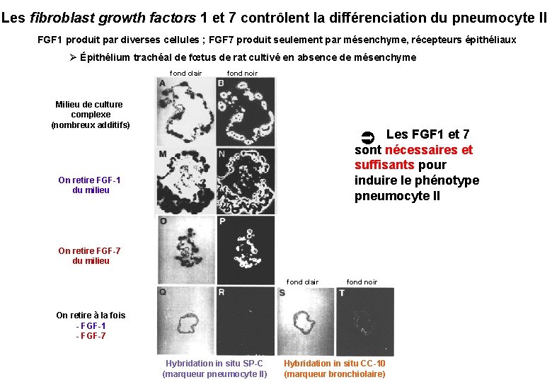 Les fibroblast growth factors 1 et 7 contrôlent la différenciation du pneumocyte II FGF