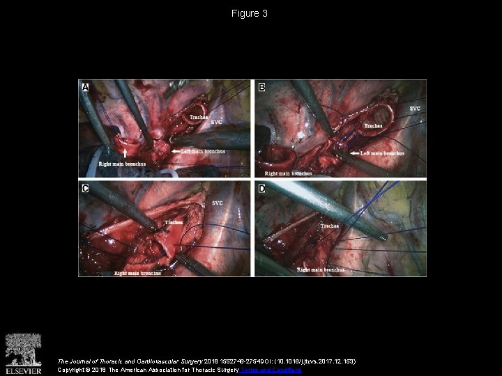 Figure 3 The Journal of Thoracic and Cardiovascular Surgery 2018 1552746 -2754 DOI: (10.