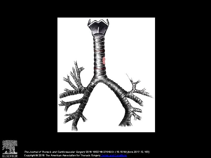 The Journal of Thoracic and Cardiovascular Surgery 2018 1552746 -2754 DOI: (10. 1016/j. jtcvs.