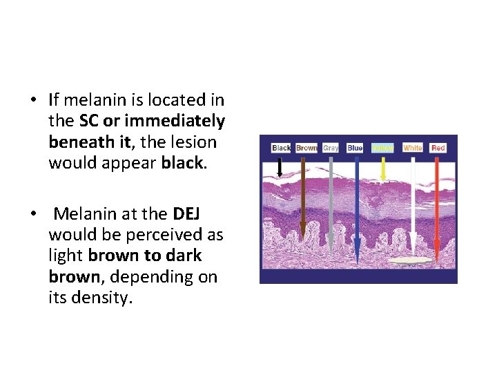 • If melanin is located in the SC or immediately beneath it, the • If melanin is located in the SC or immediately beneath it, the