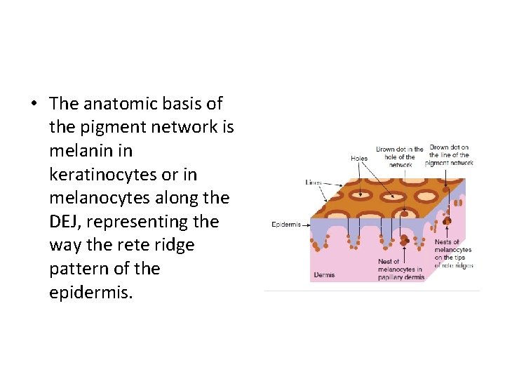 • The anatomic basis of the pigment network is melanin in keratinocytes or • The anatomic basis of the pigment network is melanin in keratinocytes or