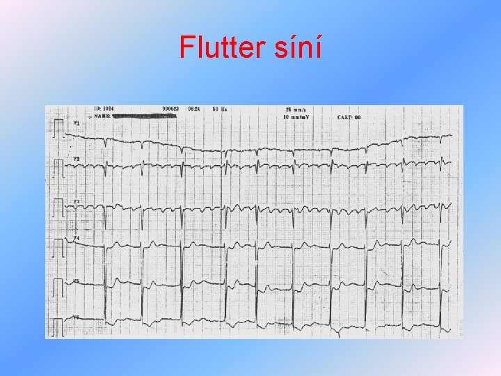 Flutter síní 