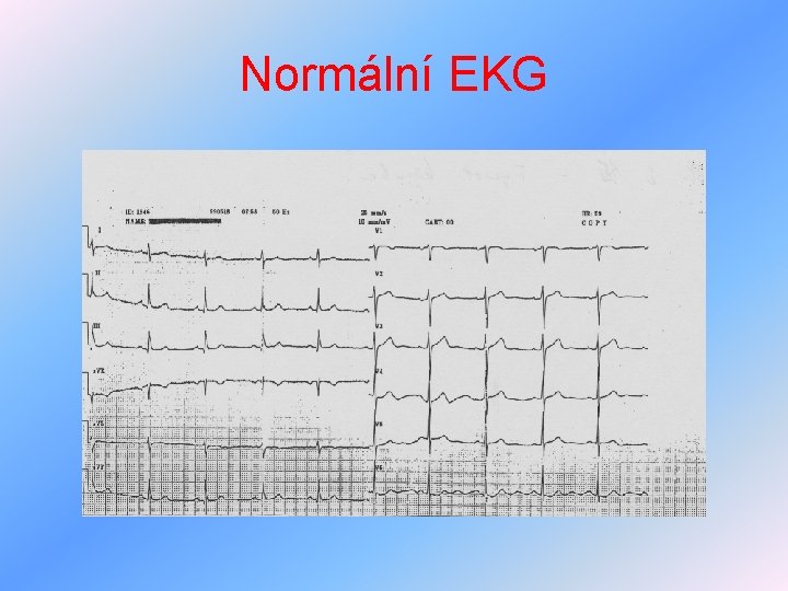 Normální EKG 