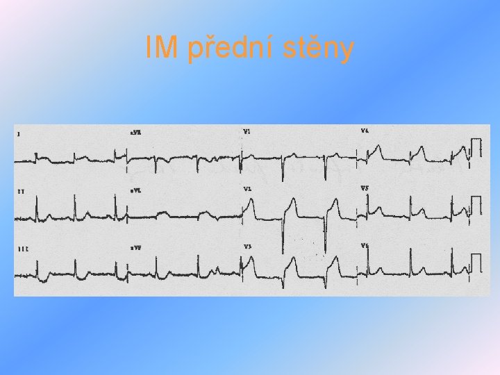 IM přední stěny 