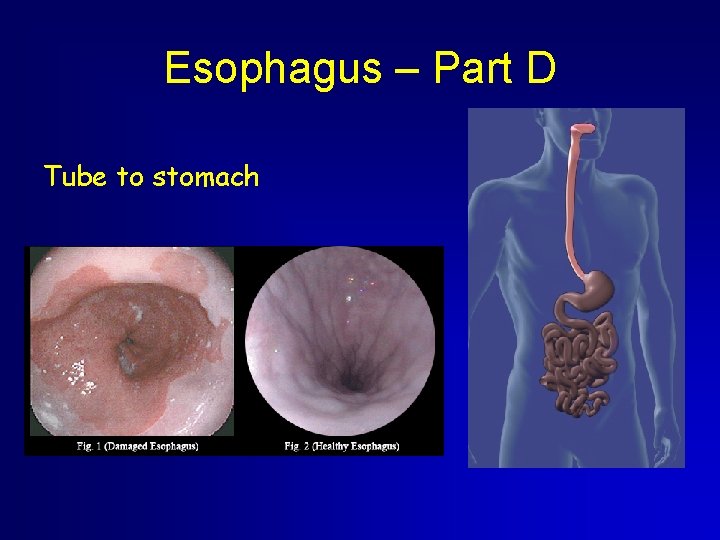 Esophagus – Part D Tube to stomach Esophagus – Part D Tube to stomach