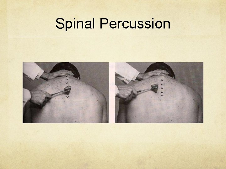 Spinal Percussion 