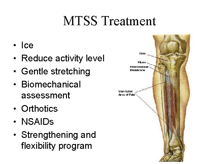 MTSS Treatment • • Ice Reduce activity level Gentle stretching Biomechanical assessment • Orthotics